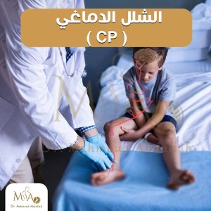 الشلل الدماغي