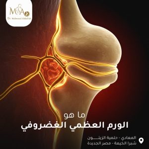 أورام العظام الخبيثة