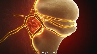 أورام العظام الخبيثة