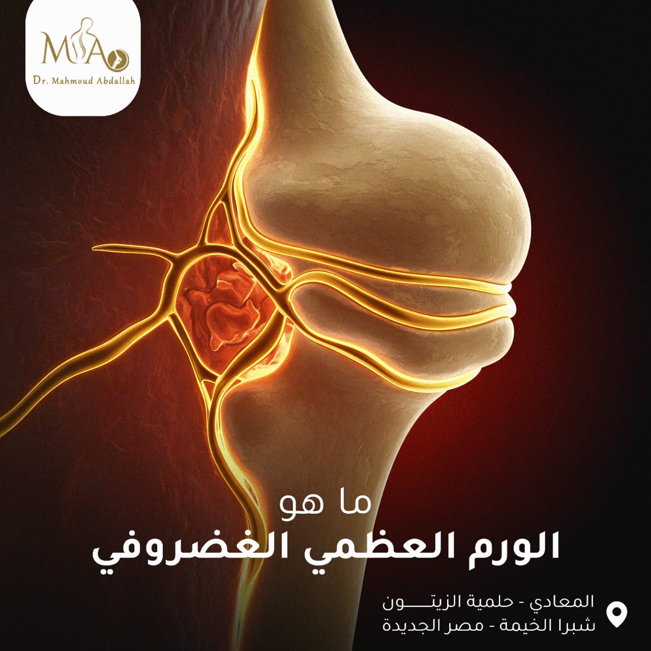 أورام العظام الخبيثة