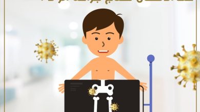 الورم العظمي الغضروفي