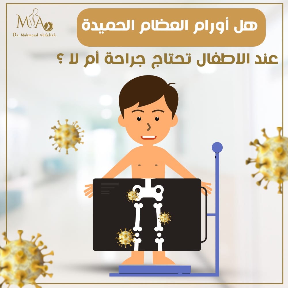 الورم العظمي الغضروفي