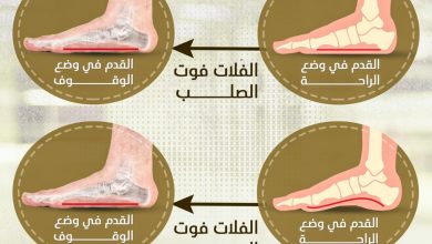 الفلات فوت المرن