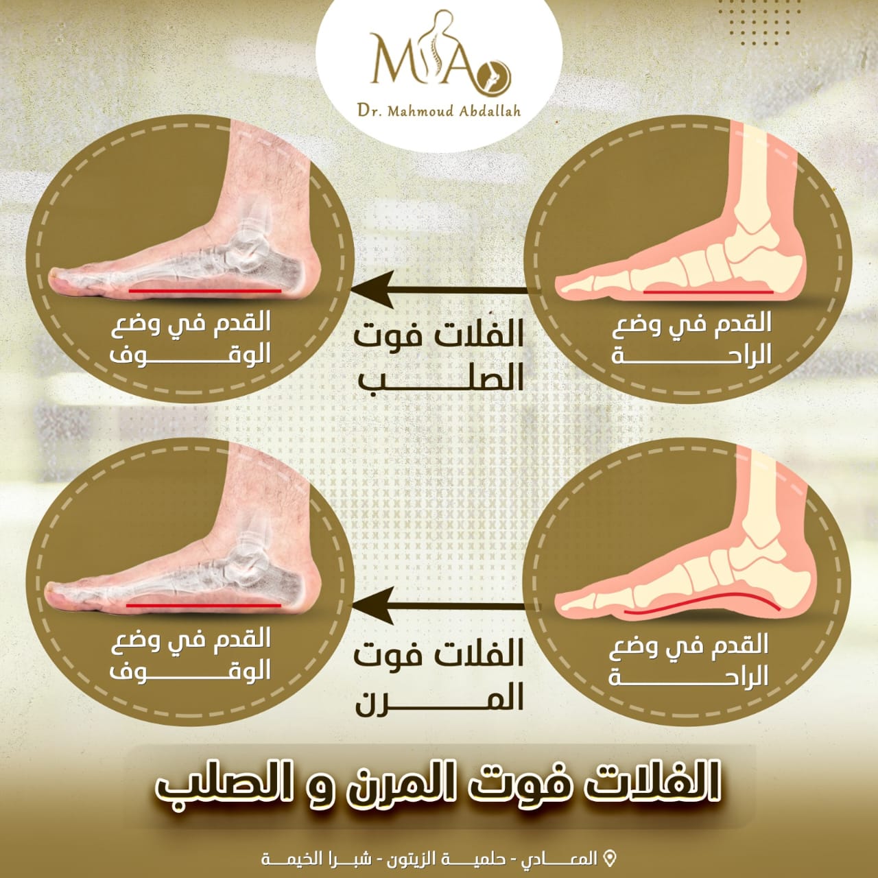 الفلات فوت المرن