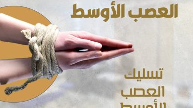 متلازمة النفق الرسغي