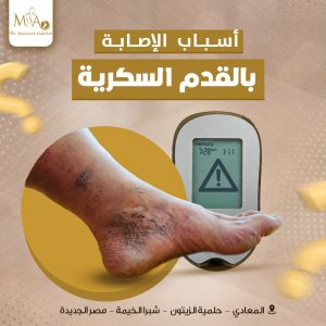 القدم السكري