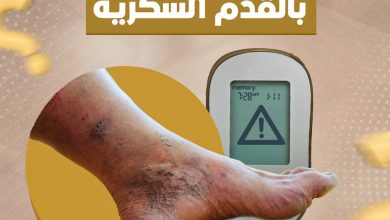 القدم السكري