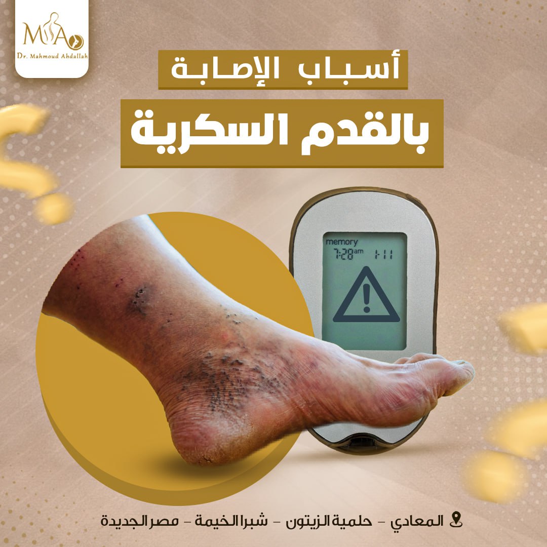 القدم السكري