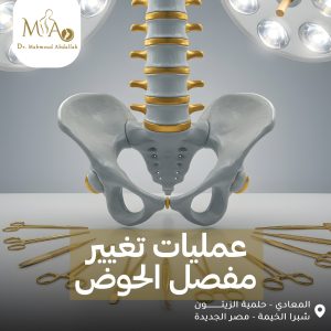 عملية تغيير مفصل الحوض