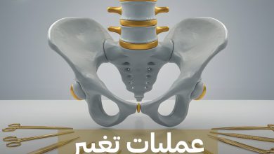 عملية تغيير مفصل الحوض