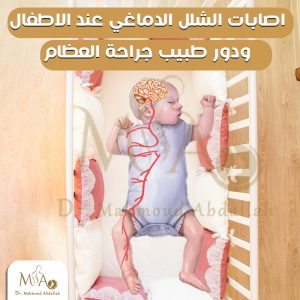 إطالة الأوتار في حالات الشلل الدماغي