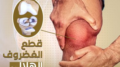 قطع الغضروف الهلالي