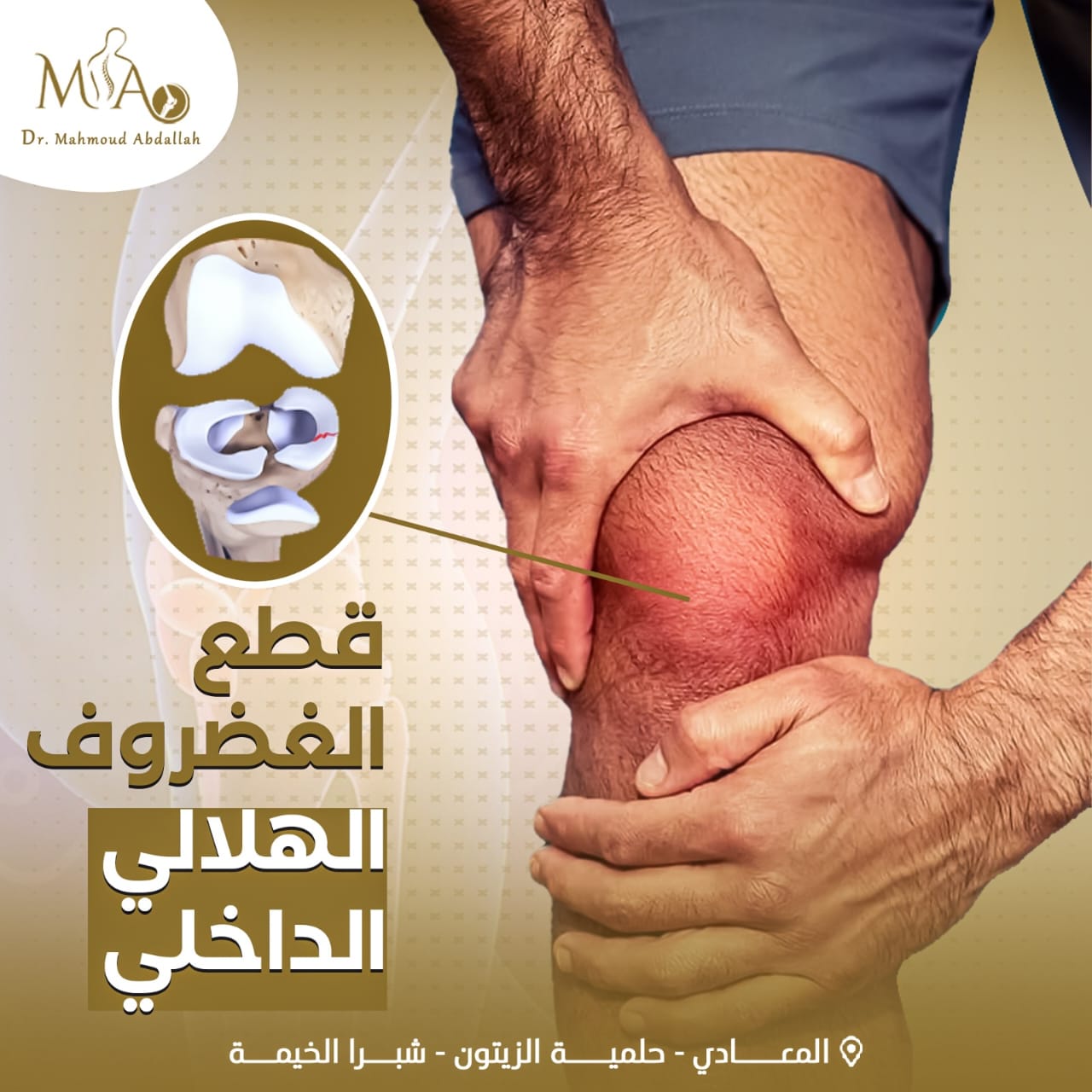 قطع الغضروف الهلالي