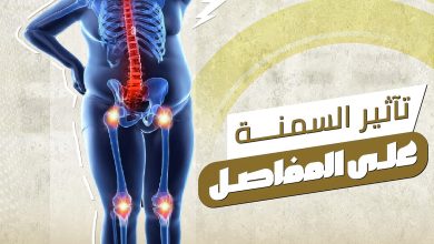 تأثير السمنة على المفاصل