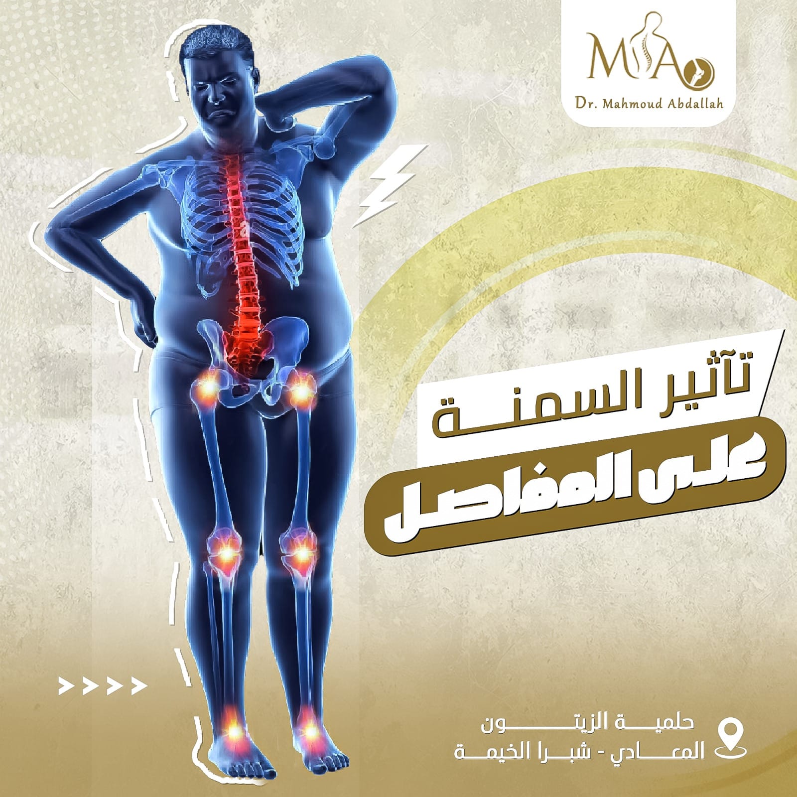 تأثير السمنة على المفاصل