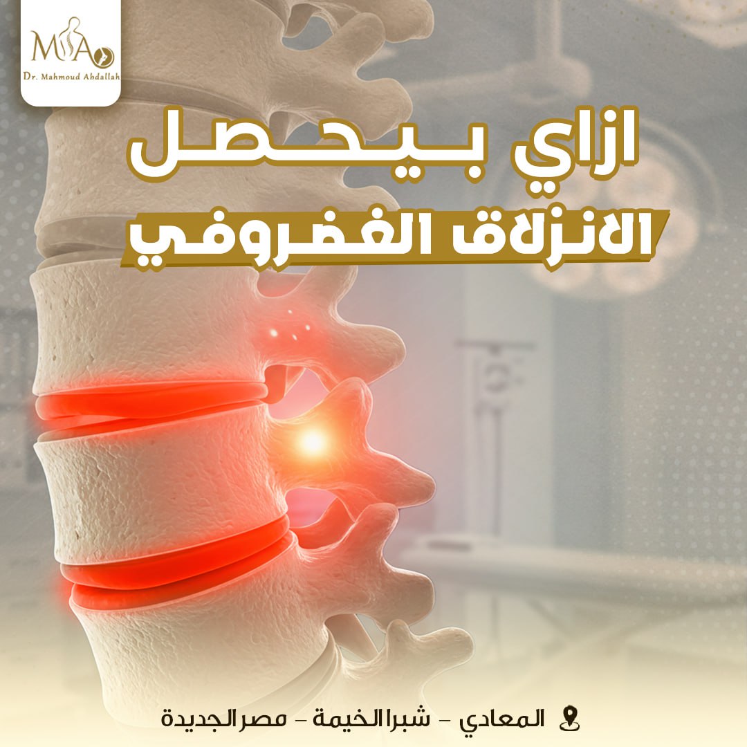 كيف يحدث الانزلاق الغضروفي