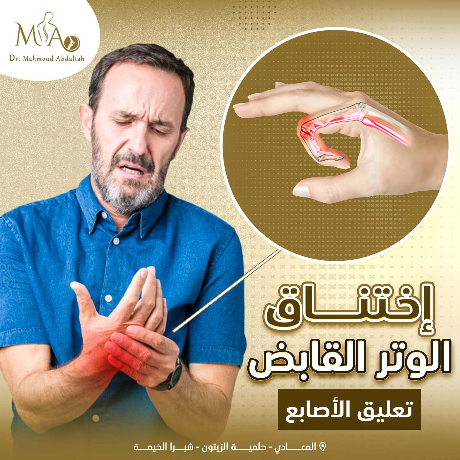 الإصبع الزنّاد Trigger Finger