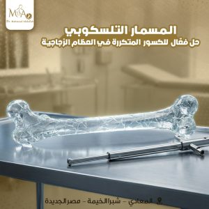 ز المسمار التليسكوبي