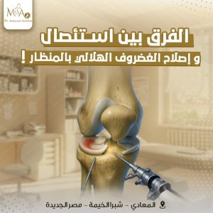 تمزق الغضروف الهلالي